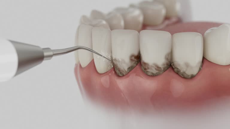 Trusted Teeth Cleaning And Checkup service in Walhalla, SC - Dentist Open Now